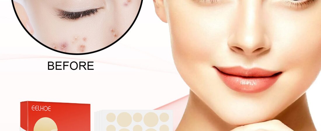 EELHOE Hydrocolloid Acne Patches Review
