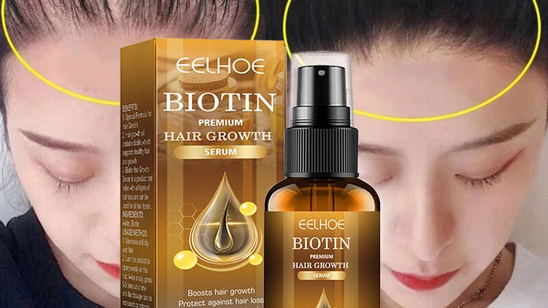Effective Solutions for Thinning Hair: Does Ginger Hair Growth Serum Work?